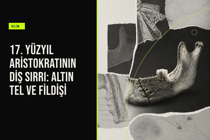 17. yüzyıl Fransız aristokratı Anne d’Alègre’nin çenesinde bulunan altın tel ve fildişi diş protezinin 3B tarama görüntüsü.