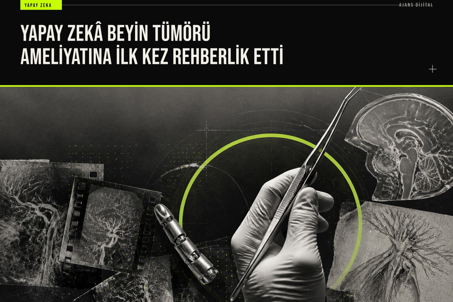 Londra NHNN hastanesinde yapay zeka destekli beyin tümörü ameliyatında cerrahlar ekrandaki sinir ve damar haritalarını takip ediyor