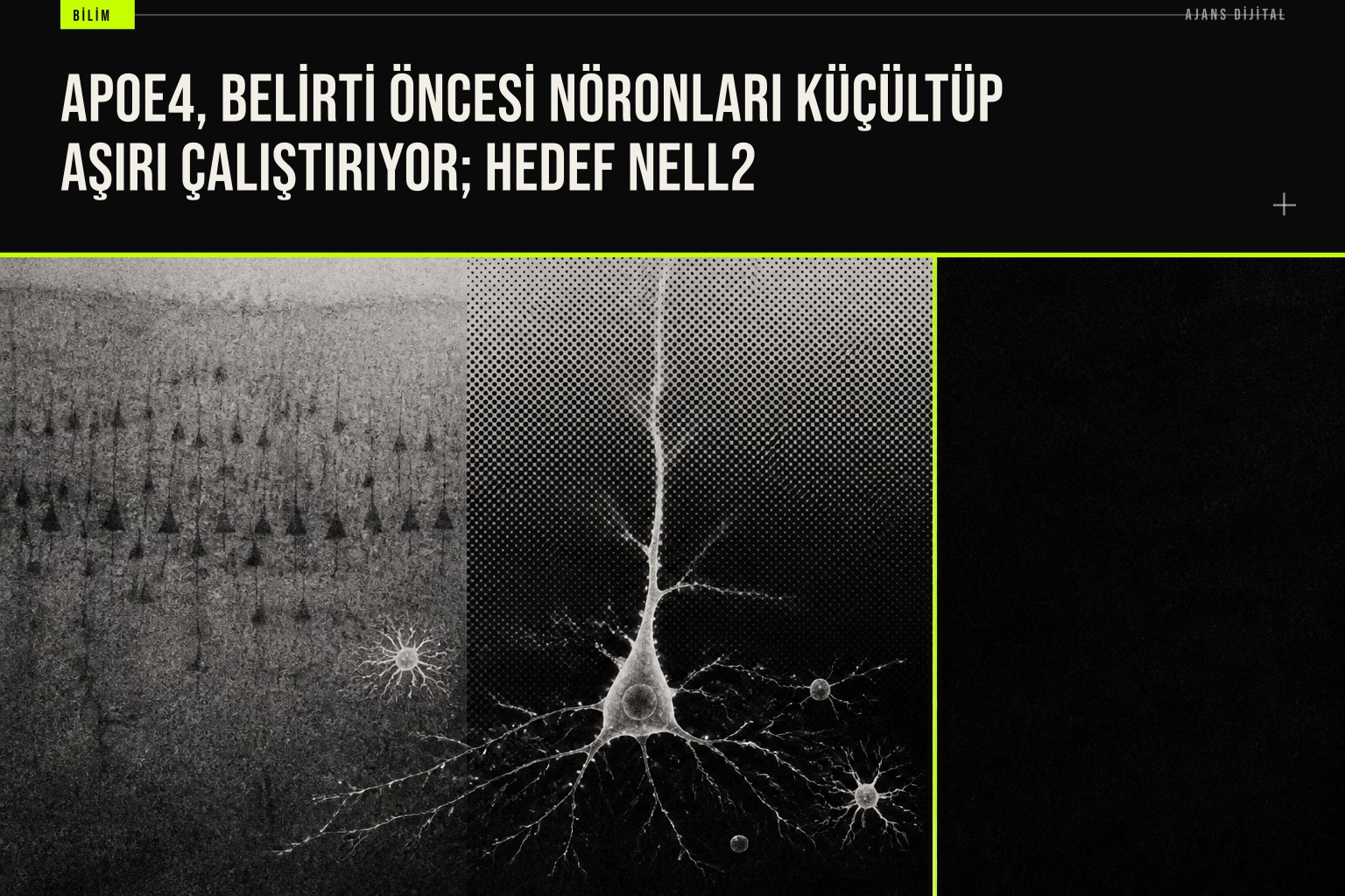 APOE4 geninin Nell2 proteinini artırarak hipokampus nöronlarını küçülterek aşırı etkinleştirdiğini gösteren bilimsel çalışma