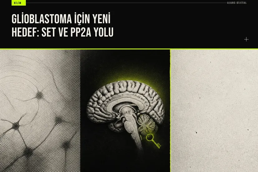 Glioblastoma hücrelerinde SET proteini inhibisyonunun tümör büyümesini durdurup radyoterapi duyarlılığını artırdığını gösteren laboratuvar bulguları.