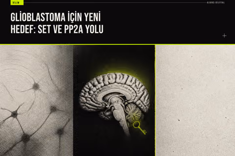 Glioblastoma hücrelerinde SET proteini inhibisyonunun tümör büyümesini durdurup radyoterapi duyarlılığını artırdığını gösteren laboratuvar bulguları.