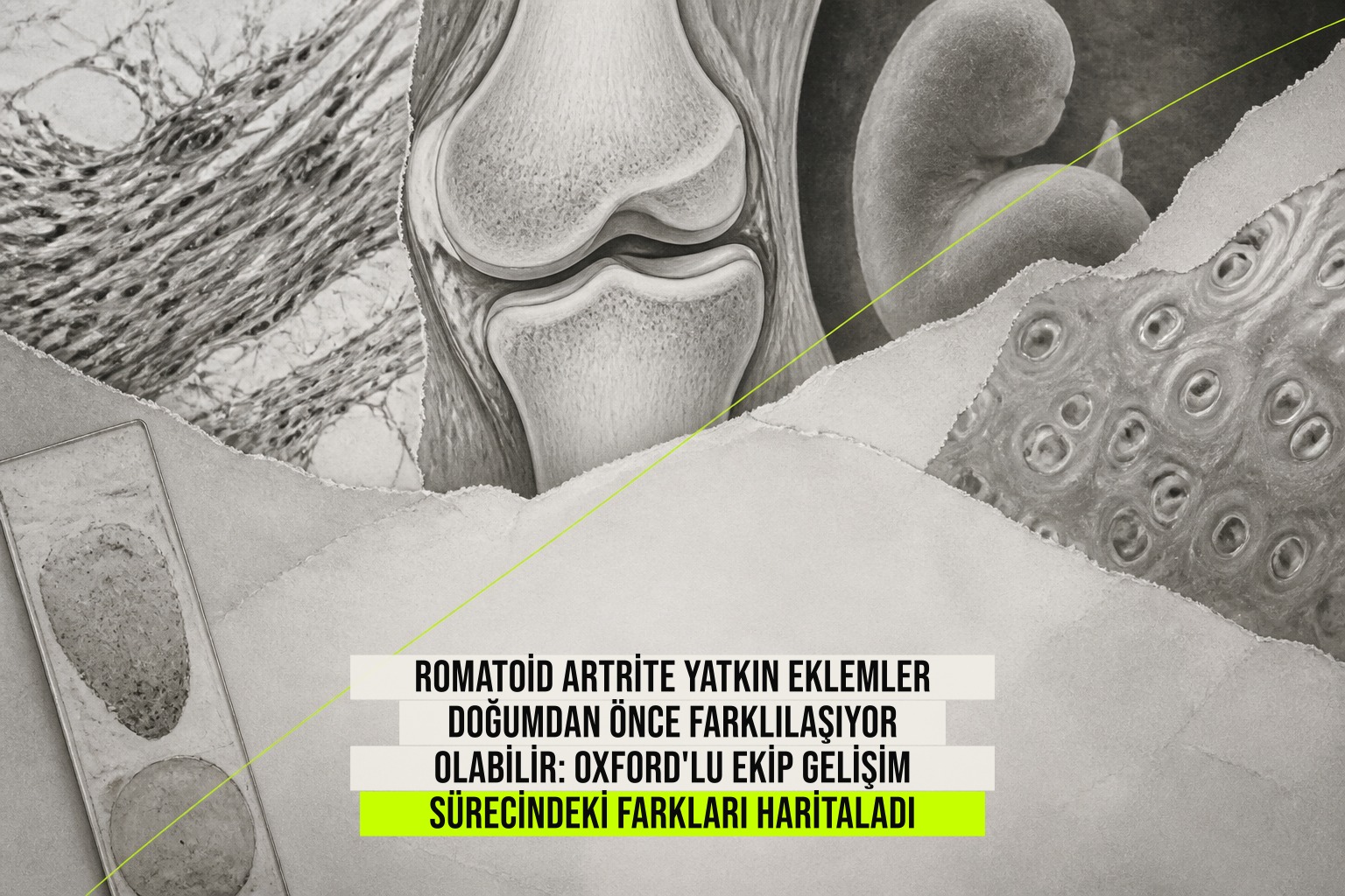 Romatoid artriteye yatkın eklemlerin gebelik içinde farklılaştığı hücre ve doku yapılarını gösteren geliştirme haritası