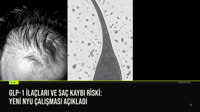 GLP-1 İlaçları ve Saç Kaybı Riski: Yeni NYU Çalışması Açıkladı haberi için üretilen kapak görseli
