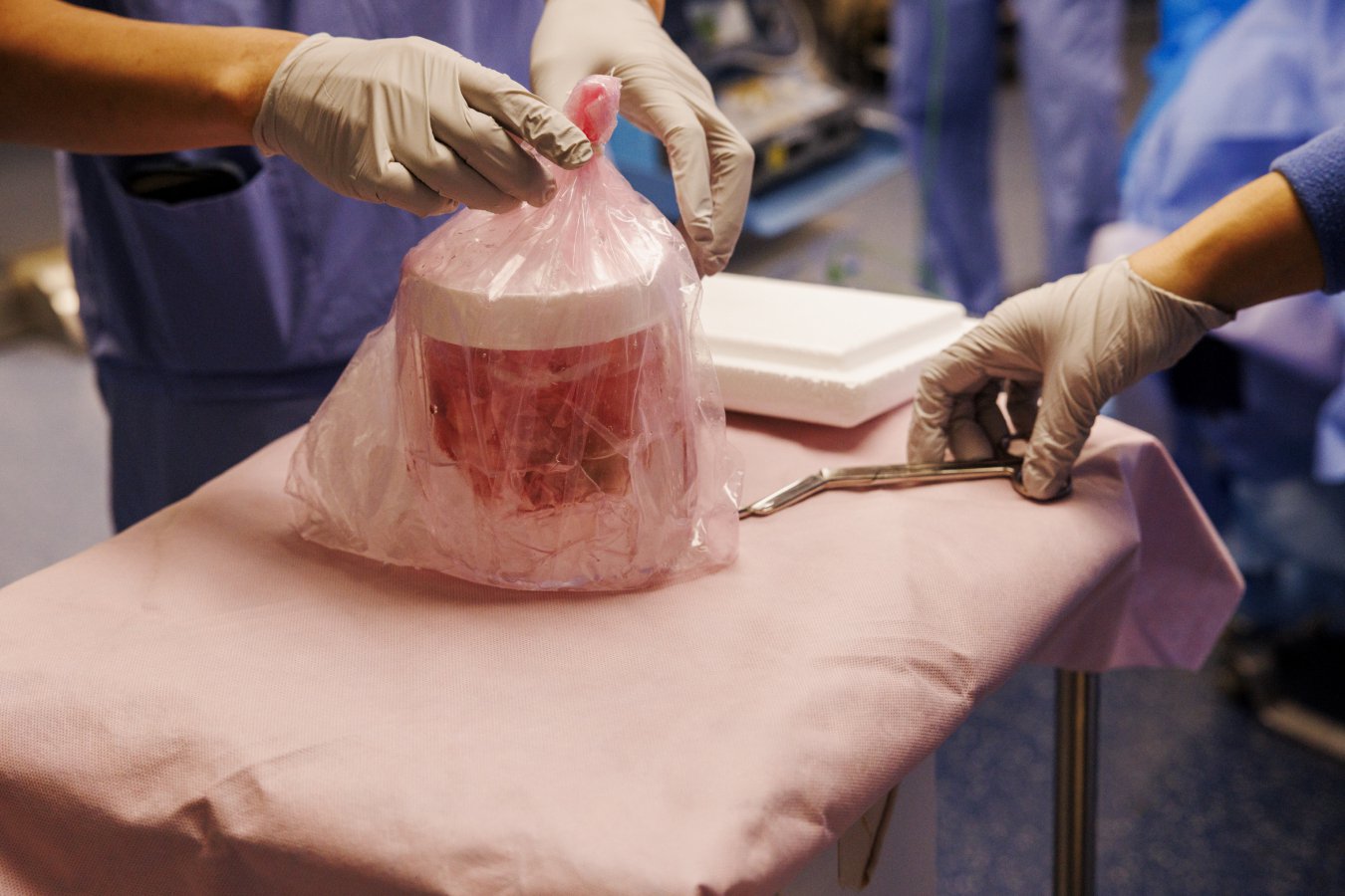 The pig kidney that was transplanted into Tim Andrews on 25 January 2025