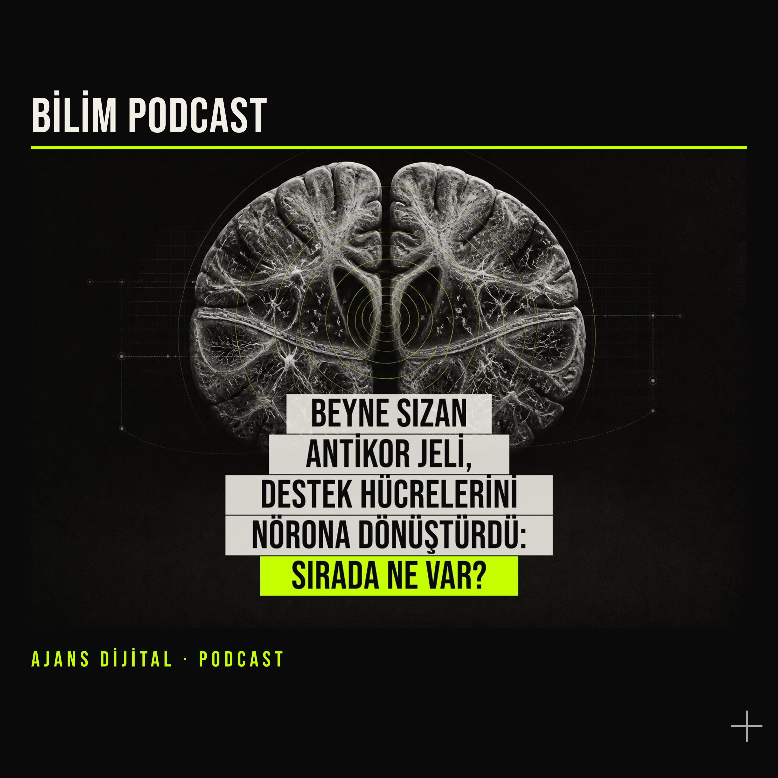 Alzheimer Farelerinde Umut Veren Jel: Beyinde Hücre Dönüşümü podcast bölümü kapağı