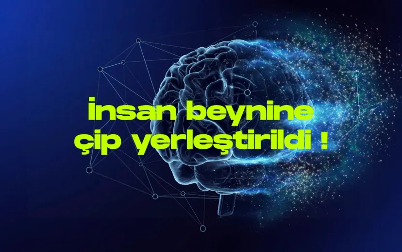 Elon musk duyurdu ilk kez insan beynine cip yerlestirildi