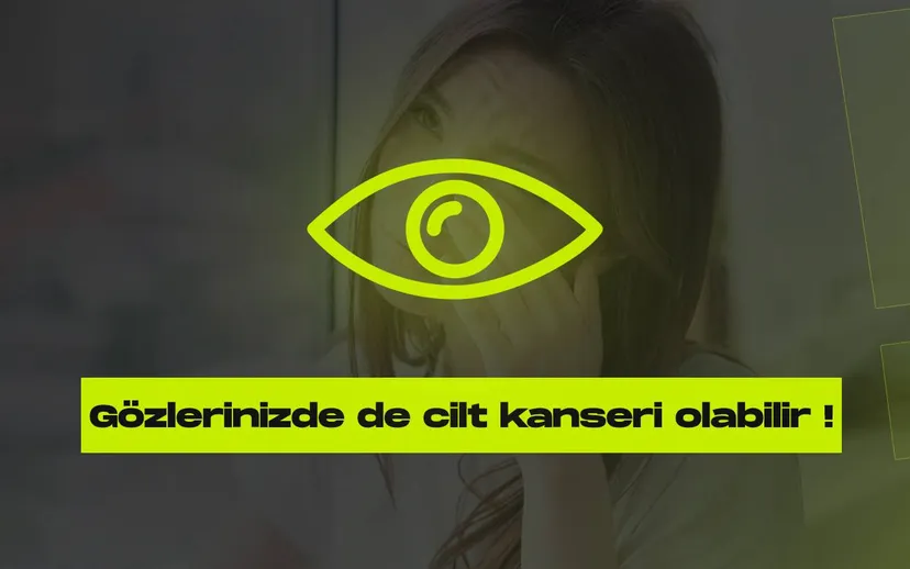 Gozlerinizde de cilt kanseri olabilir iste cilt kanseri olabilecek yerler