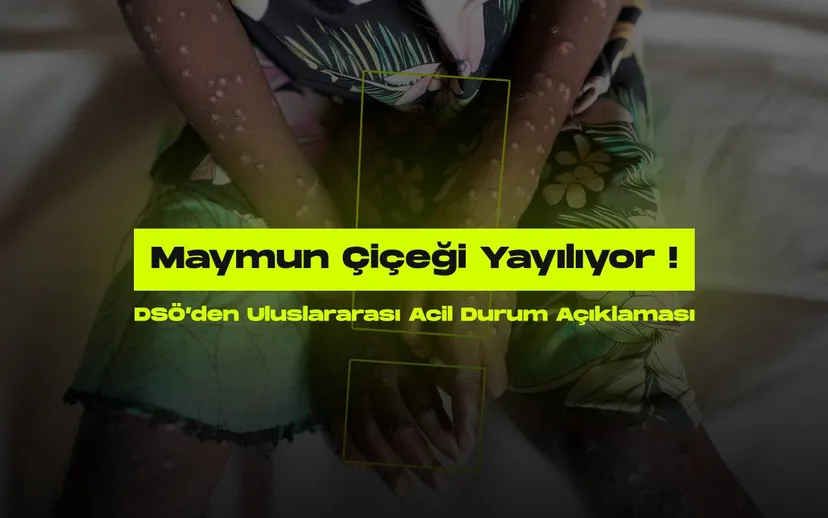 Dunya saglik orgutunden maymun cicegi icin yeni uyari
